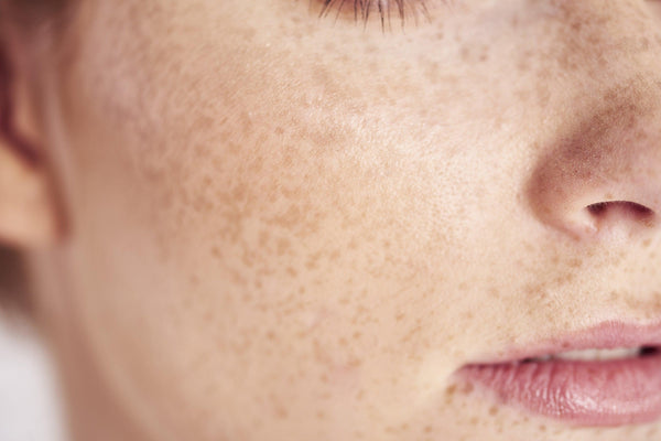 Quels soins visage pour ma peau sensible ?